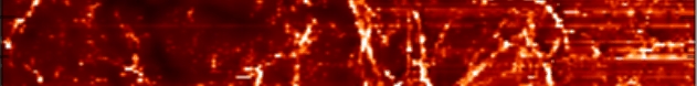 view eukaryotic transcriptional and post